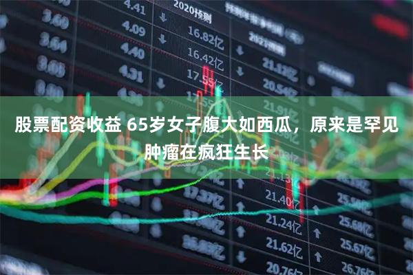 股票配资收益 65岁女子腹大如西瓜，原来是罕见肿瘤在疯狂生长